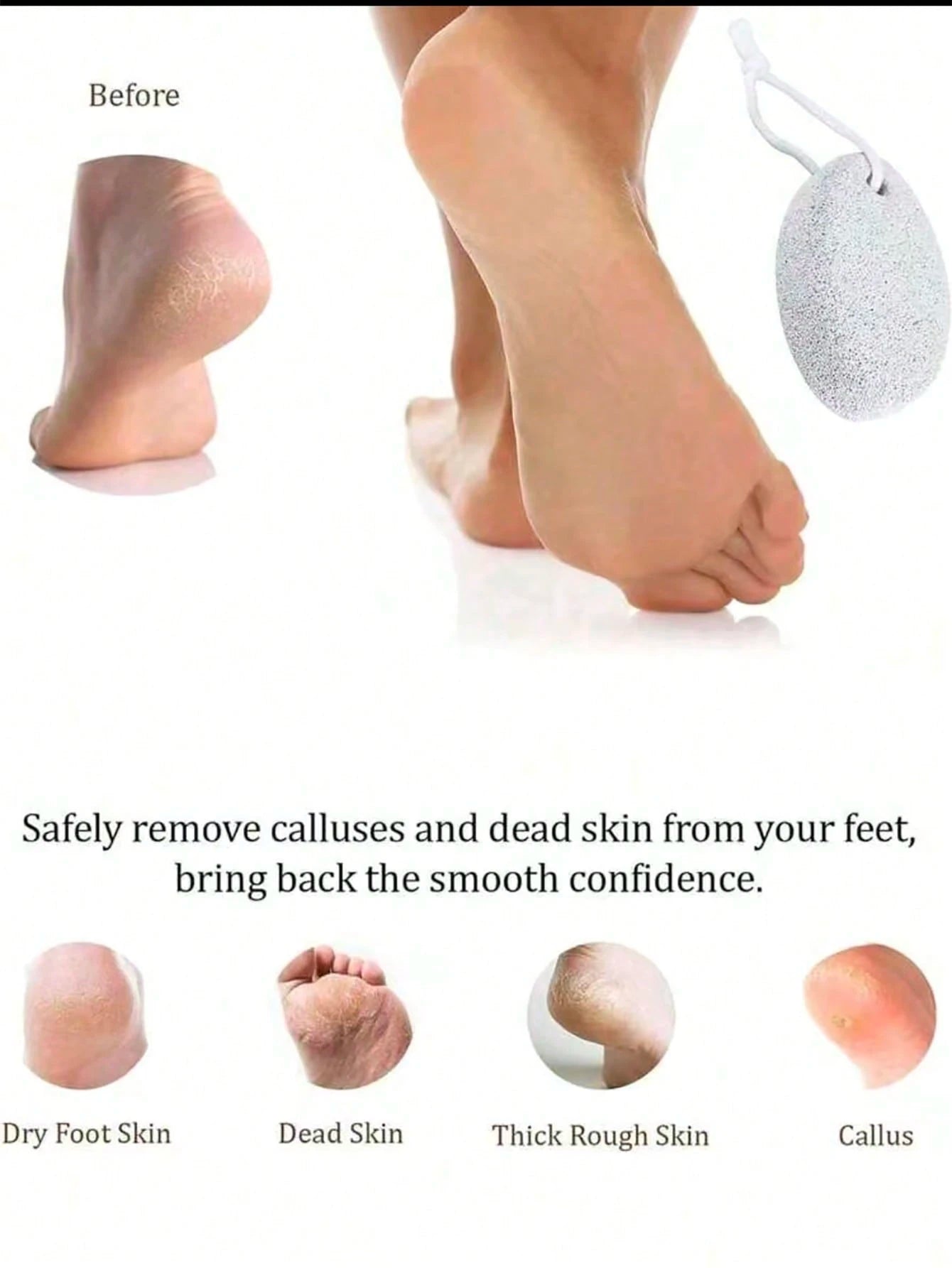 Natural Pumice Stone, Reusable Foot Care Tool, Foot And Hand Hard Skin Callus Remover, Callus Remover With Pumice Stone, Professional Foot Care Tool Set, Foot Scrub, Suitable For Severe Calluses On Fe