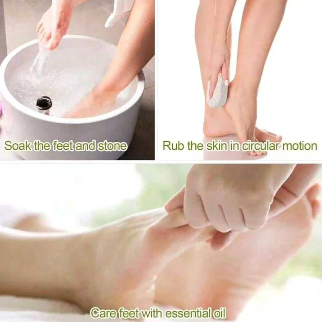 Natural Pumice Stone, Reusable Foot Care Tool, Foot And Hand Hard Skin Callus Remover, Callus Remover With Pumice Stone, Professional Foot Care Tool Set, Foot Scrub, Suitable For Severe Calluses On Fe