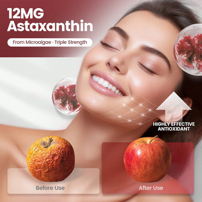 VivoNu Astaxanthin 12mg, 240 Softgel Capsules, Fresh Rain Red Algae, 10 In 1 Astaxanthin Antioxidant Supplement, Containing Lycopene, Grape Seeds, Vitamin E, Etc., Supporting Eye, Joint, And Skin Heal